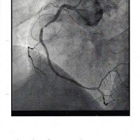 Riese Original Herzarterie